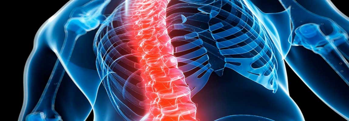 TMERT ModoPrevencion